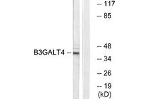 Image no. 1 for anti-UDP-Gal:betaGlcNAc beta 1,3-Galactosyltransferase, Polypeptide 4 (B3GALT4) (AA 181-230) antibody (ABIN1534690)
