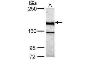 Image no. 1 for anti-Unc-13 Homolog B (UNC13B) (Center) antibody (ABIN2856798)