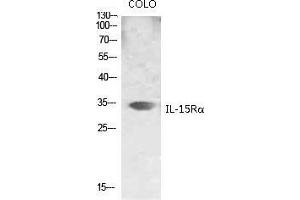Image no. 2 for anti-Interleukin 15 Receptor, alpha (IL15RA) (Internal Region) antibody (ABIN3185159)