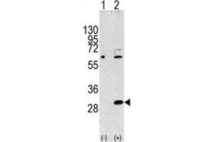 Image no. 3 for anti-Eukaryotic Translation Initiation Factor 4E Family Member 2 (EIF4E2) (AA 12-41) antibody (ABIN3030894)