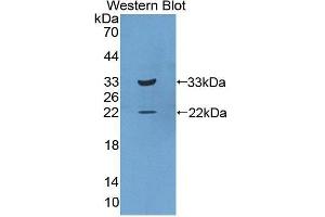 Image no. 1 for anti-Interleukin 20 Receptor beta (IL20RB) (AA 37-290) antibody (ABIN1859401)