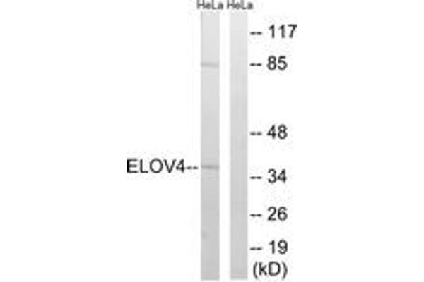 anti-ELOVL Fatty Acid Elongase 4 (ELOVL4) (AA 41-90) antibody