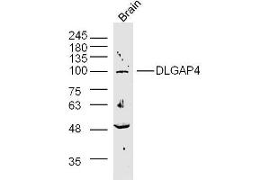 Image no. 2 for anti-Discs, Large (Drosophila) Homolog-Associated Protein 4 (DLGAP4) (AA 261-370) antibody (ABIN1386704)