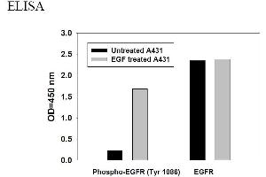 Image no. 6 for Epidermal Growth Factor Receptor (EGFR) ELISA Kit (ABIN625224)