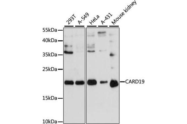 C9orf89 antibody  (AA 1-100)
