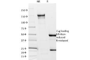 Image no. 1 for anti-Flagellin (FliC) antibody (ABIN6941315)