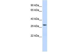 Image no. 1 for anti-Mitochondrial Translational Initiation Factor 3 (MTIF3) (Middle Region) antibody (ABIN2786266)