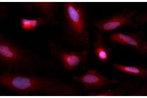 Image no. 1 for anti-Copper Chaperone For Superoxide Dismutase (CCS) (AA 1-274) antibody (APC) (ABIN5565328)