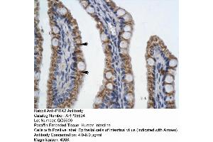 Image no. 2 for anti-Paired-Like Homeodomain 2 (PITX2) (N-Term) antibody (ABIN2776373)