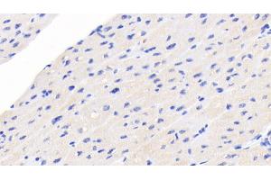 NT-ProBNP anticorps  (AA 27-102)