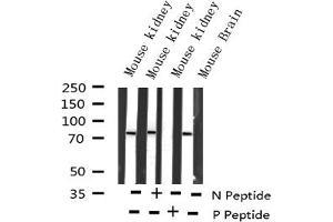 Image no. 2 for anti-V-Rel Reticuloendotheliosis Viral Oncogene Homolog B (RELB) (pSer573) antibody (ABIN6255407)