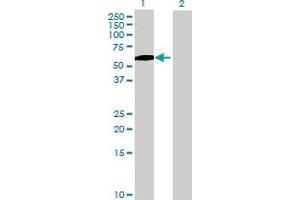 Image no. 1 for anti-Carboxypeptidase, Vitellogenic-Like (CPVL) (AA 1-476) antibody (ABIN527091)
