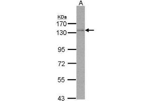 Image no. 2 for anti-Polymerase (DNA Directed), delta 1, Catalytic Subunit 125kDa (POLD1) (Center) antibody (ABIN2855506)