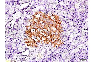 Image no. 1 for anti-Pancreatic and Duodenal Homeobox 1 (PDX1) (AA 188-284) antibody (ABIN729883)