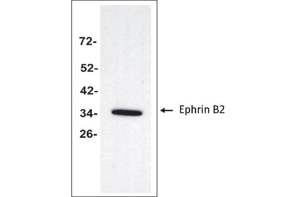 anti-Ephrin B2 (EFNB2) (Extracellular Domain) antibody