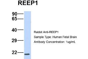 Image no. 1 for anti-Receptor Accessory Protein 1 (REEP1) (C-Term) antibody (ABIN2783893)