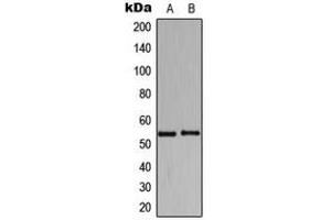 Image no. 1 for anti-Histidyl-tRNA Synthetase (HARS1) (C-Term) antibody (ABIN2704873)