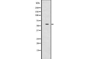 Image no. 1 for anti-UDP Glucuronosyltransferase 2 Family, Polypeptide B17 (UGT2B17) (N-Term) antibody (ABIN6265877)