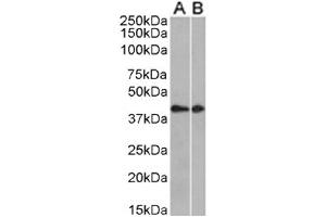 CCRL2 抗体  (AA 1-24)