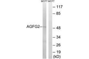 Image no. 1 for anti-ArfGAP with FG Repeats 2 (AGFG2) (AA 91-140) antibody (ABIN1534978)