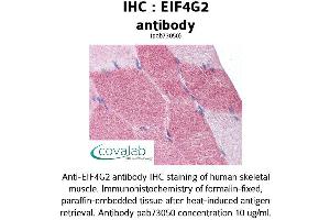 Image no. 2 for anti-Eukaryotic Translation Initiation Factor 4 gamma 2 (EIF4G2) (AA 1-204) antibody (ABIN1733958)