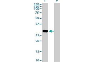 Image no. 1 for anti-Distal-Less Homeobox Protein 1 (DLX1) (AA 1-255) antibody (ABIN515003)