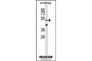 Image no. 1 for anti-Aldehyde Dehydrogenase 1 Family, Member A3 (ALDH1A3) (AA 24-51), (N-Term) antibody (ABIN392316)