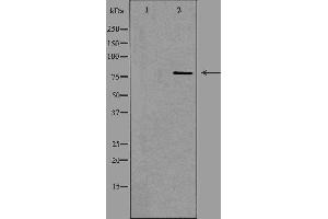 Image no. 2 for anti-Adenosine Deaminase, RNA-Specific, B1 (ADARB1) antibody (ABIN6257927)