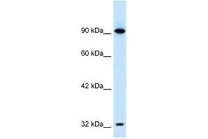 Image no. 1 for anti-SRY (Sex Determining Region Y)-Box 30 (SOX30) (Middle Region) antibody (ABIN2779511)