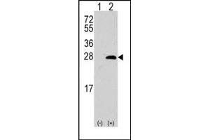 Image no. 1 for anti-sigma Non-Opioid Intracellular Receptor 1 (SIGMAR1) (Middle Region) antibody (ABIN357897)