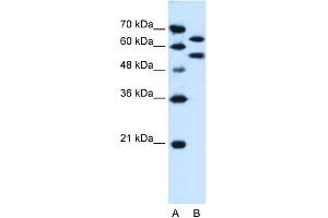 Image no. 1 for anti-Nucleotide Exchange Factor SIL1 (SIL1) (N-Term) antibody (ABIN2782036)