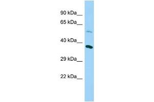 Image no. 1 for anti-Chromosome 20 Open Reading Frame 7 (C20orf7) (N-Term) antibody (ABIN2790612)