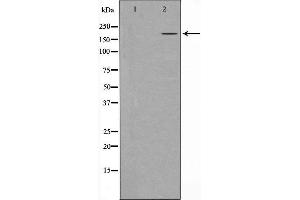 Image no. 1 for anti-Tet Methylcytosine Dioxygenase 1 (TET1) (Internal Region) antibody (ABIN6265522)