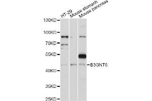 Image no. 1 for anti-UDP-GlcNAc:betaGal beta-1,3-N-Acetylglucosaminyltransferase 6 (Core 3 Synthase) (B3GNT6) antibody (ABIN6292802)