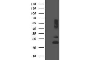 Image no. 7 for anti-Receptor Accessory Protein 5 (REEP5) antibody (ABIN1500659)