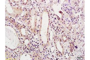 Formalin-fixed and paraffin embedded human kidney labeled with Anti-HNF1/TCF1/HNF1A Polyclonal Antibody, Unconjugated (ABIN686077) at 1:200 followed by conjugation to the secondary antibody and DAB staining.