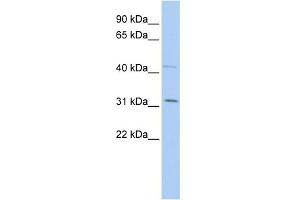 anti-SIX Homeobox 1 (SIX1) (Middle Region) antibody