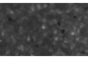 Image of the maximum plot of the fluorescence intensity (F/F0) of a Fluo3-stained culture of SiMa human neuroblastoma cells pretreated for 12 h with 10 μg/ml of α-CJe, and subsequently perfused for 50 s with 10 nmol/l of ACh in standard bath solution.