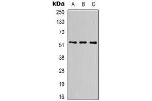 Image no. 4 for anti-alpha Tubulin (TUBA1) antibody (ABIN2852681)
