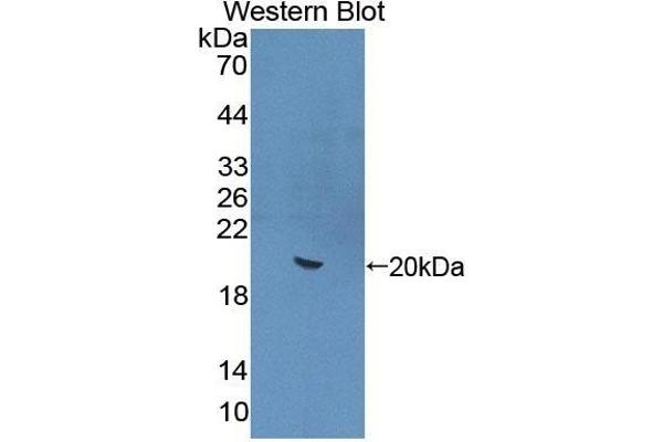 IL-22 antibody  (AA 34-179)