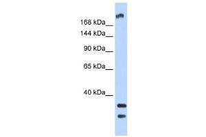 Image no. 2 for anti-Transient Receptor Potential Cation Channel, Subfamily M, Member 2 (TRPM2) (N-Term) antibody (ABIN635099)