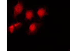 Image no. 3 for anti-Histone Deacetylase 6 (HDAC6) (pSer22) antibody (ABIN6255100)
