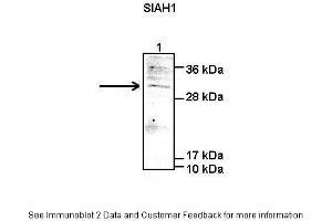 Image no. 3 for anti-E3 Ubiquitin-Protein Ligase SIAH1 (SIAH1) (C-Term) antibody (ABIN2780459)