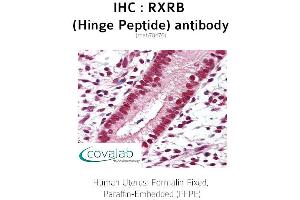 Image no. 2 for anti-Retinoid X Receptor, beta (RXRB) antibody (ABIN1724387)