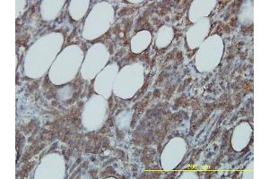 Image no. 4 for anti-Cell Division Cycle 37 Homolog (S. Cerevisiae) (CDC37) (AA 1-378) antibody (ABIN564833)