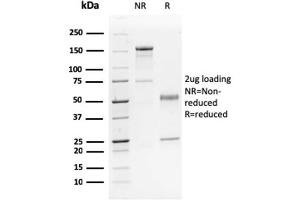 Image no. 1 for anti-Tumor Protein P63 (TP63) antibody (ABIN6940967)
