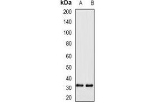 Image no. 3 for anti-Williams Beuren Syndrome Chromosome Region 22 (WBSCR22) antibody (ABIN2967146)