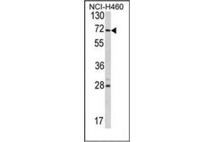 Image no. 1 for anti-Ubiquitin Specific Peptidase 21 (USP21) (AA 232-262), (Middle Region) antibody (ABIN357424)