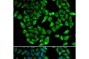 Immunofluorescence analysis of HeLa cells using ASIP Polyclonal Antibody