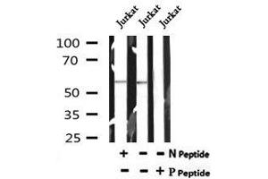 Image no. 3 for anti-Lymphocyte-Specific Protein tyrosine Kinase (LCK) (pTyr192) antibody (ABIN6269805)